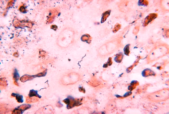 ¿Qué es el Treponema y cuáles son sus características?