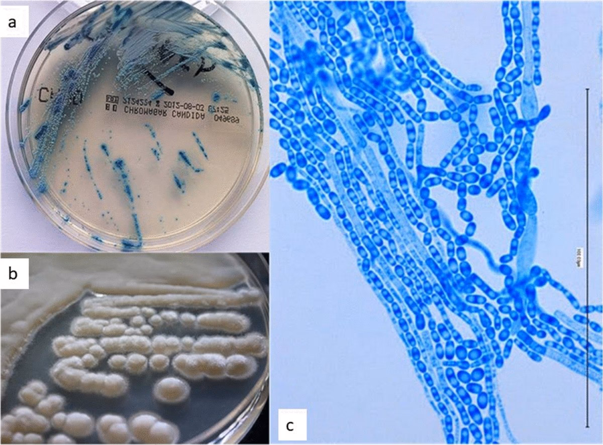 Can Trichosporon spp cause invasive infections?