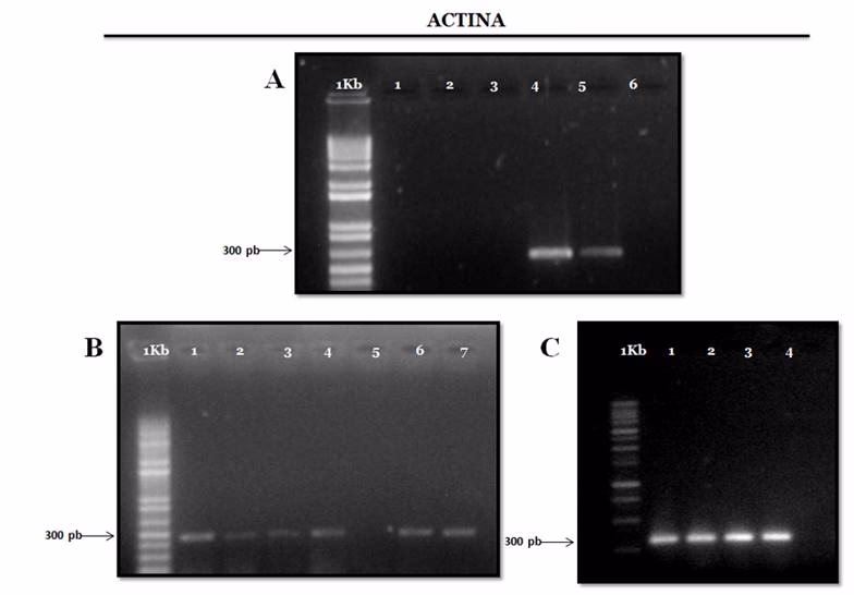 ¿Cómo hacer trizol con cloroformo?