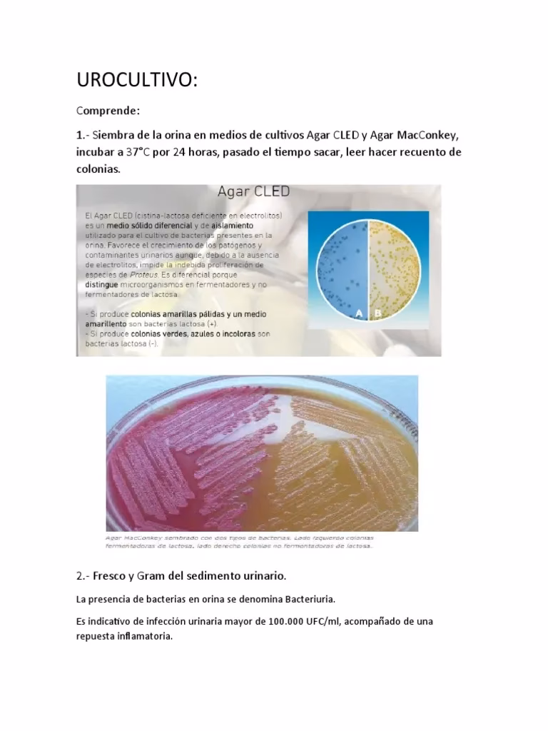 ¿Cuándo es necesario pedir un urocultivo?