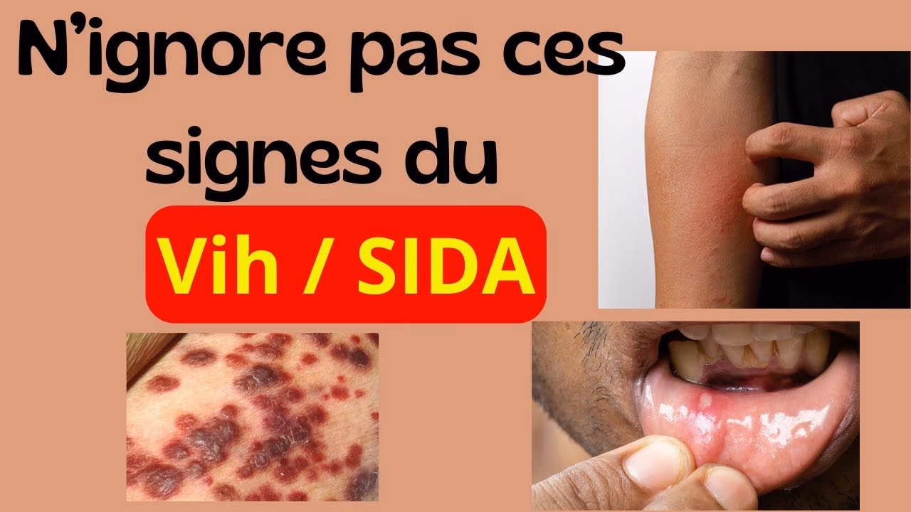 Est-ce que le VIH se transmet après 10 rapports ?
